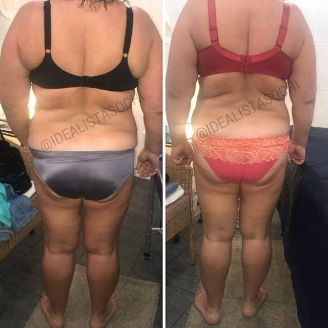 Фото до и после массажа тела - 2