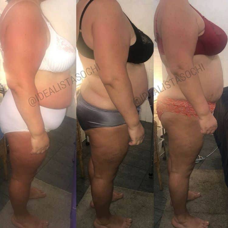 Фото до и после массажа тела